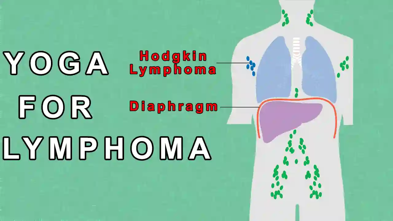Yoga for Lymphoma - Cure Cancer of the Lymphatic system by Yoga