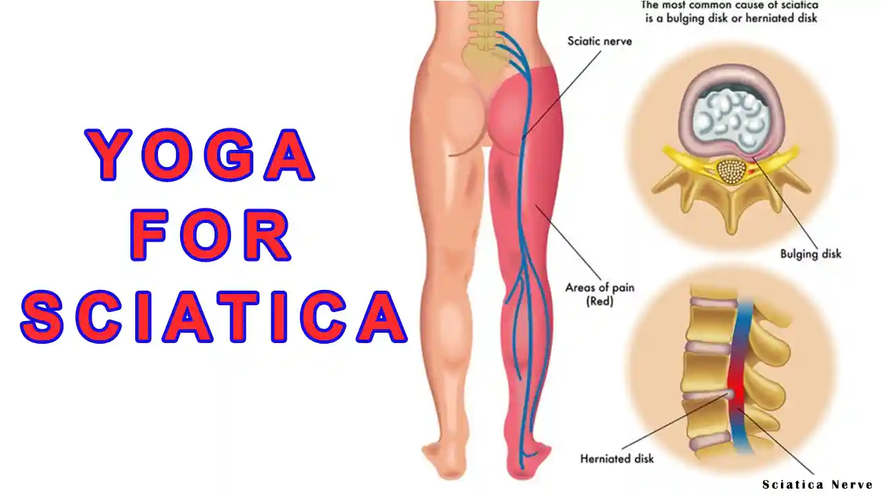 Yoga for Sciatica Pain: 10 Poses to Relief Sciatica 